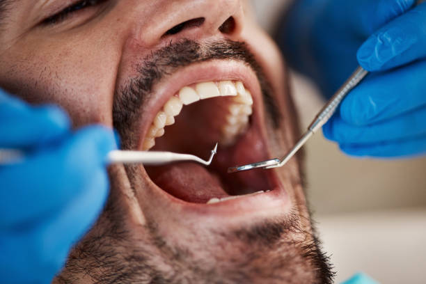 Best Emergency Denture Repair in Chatsworth, IL