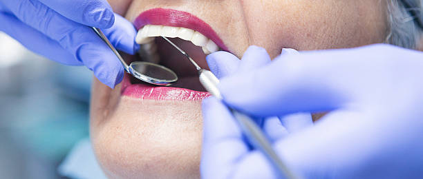 Best Urgent Care for Lost Fillings or Crowns in Chatsworth, IL